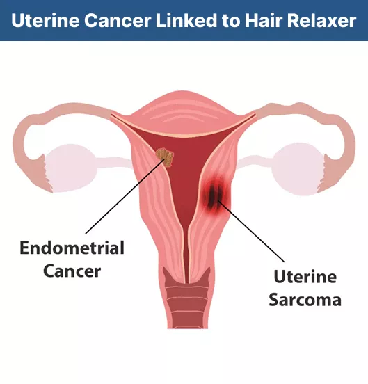 cancer